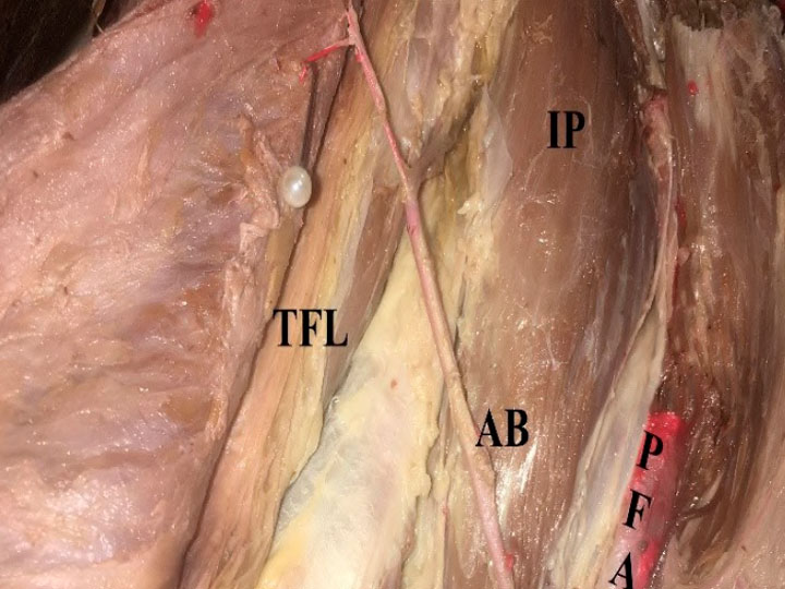 Anatomical study of the anterolateral perforators of the thigh and its clinical applications