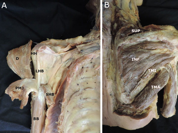 A new student-led dissection approach to the glenohumeral joint
