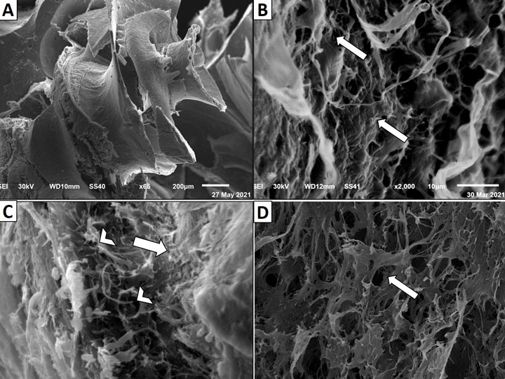 Possible ameliorative effects of pentoxifylline on cisplatin-induced ototoxicity in rats: a study with hearing test, light, and scanning electron microscopy