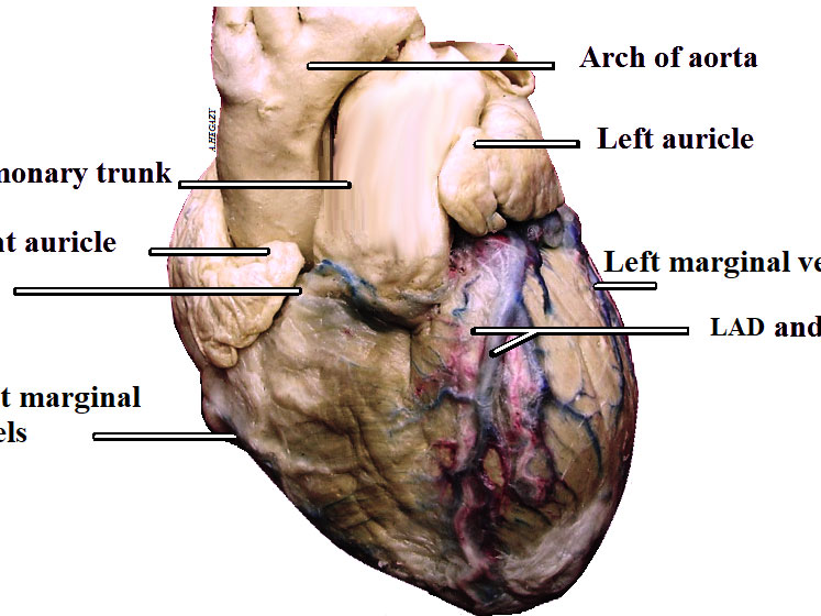 A systematic review on normal and abnormal anatomy of coronary arteries