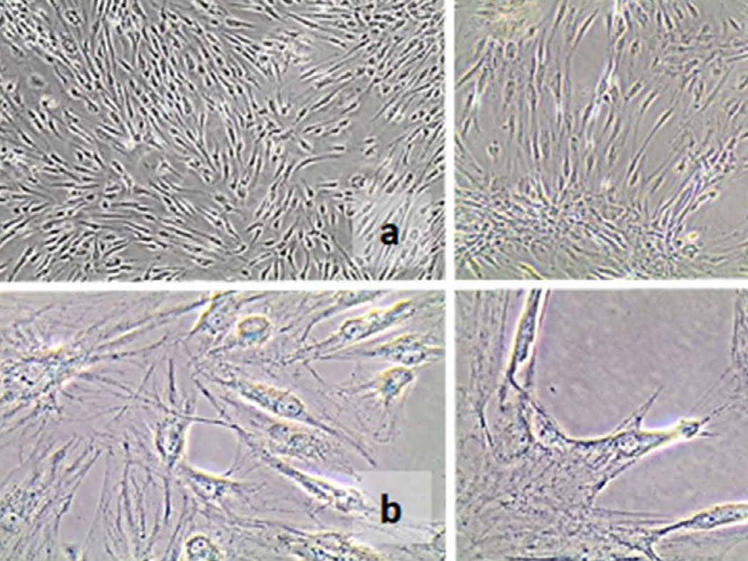Reversion of neuronal differentiation induced in human adipose-derived stem cells